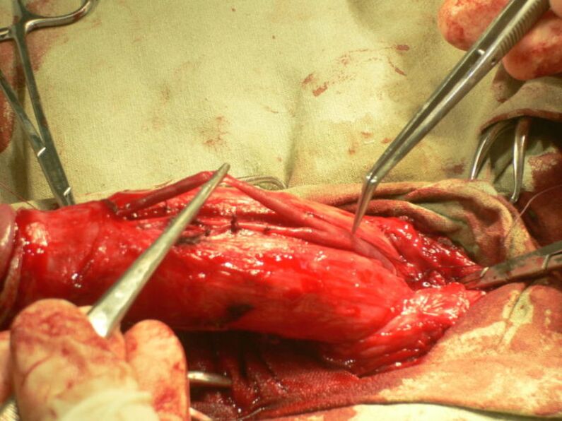 varpos lipofilizavimas siekiant padidinti